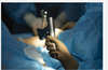 Precision Electropolishing for Medical Instruments-Image